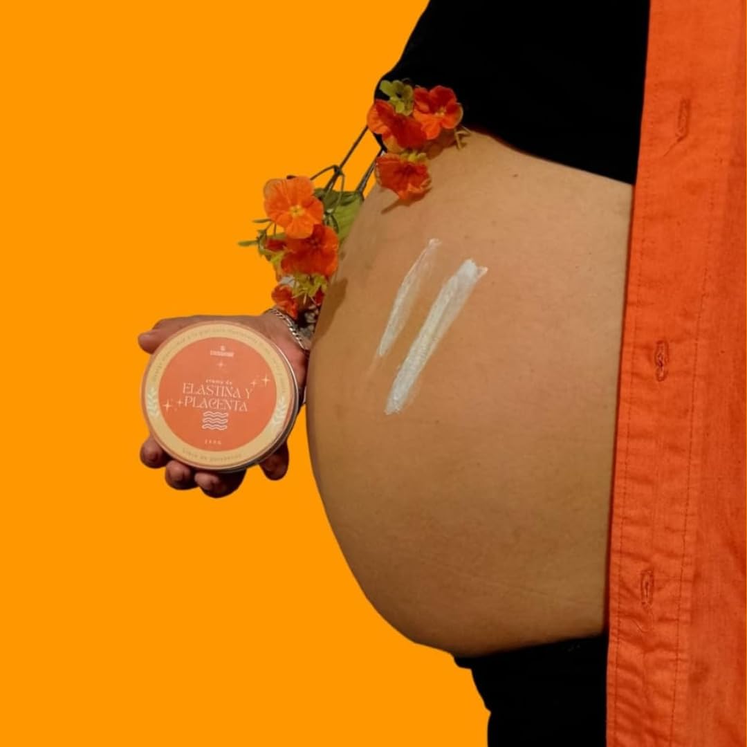 Prepara tu piel en el embarazo