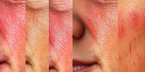 Retinol: Rompiendo Mitos